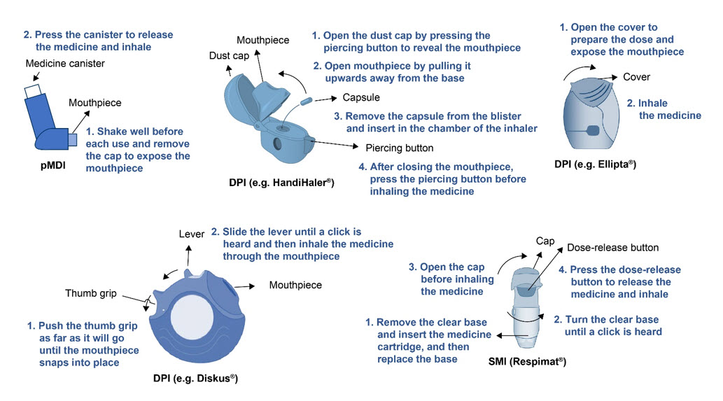 Features of some commonly used inhalers. | Click to view full size Features of some commonly used inhalers