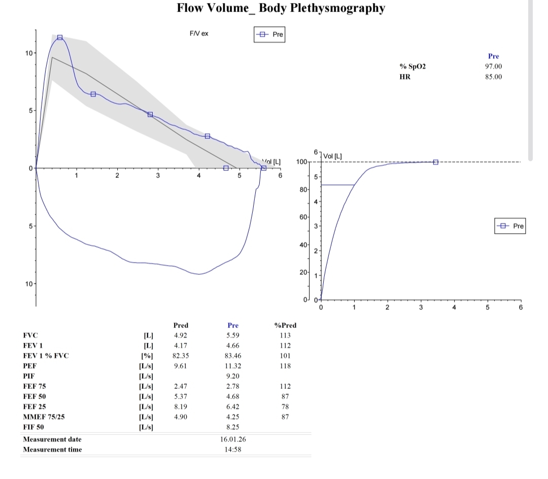 Unusual spirometry results—looking for experiences or insights