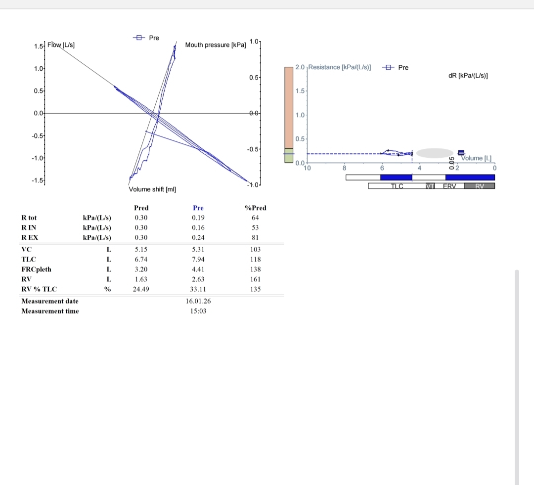 Unusual spirometry results—looking for experiences or insights